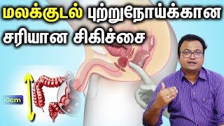 Rectal Cancer மலக்குடல் புற்றுநோய்க்கான சரியான சிகிச்சை Dr Dayananda Srinivasan [upl. by Onairot]