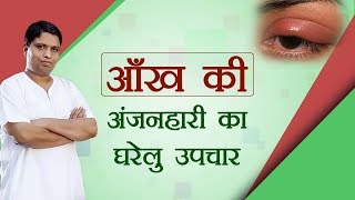 आँख की अंजनहारी का घरेलु उपचार  Acharya Balkrishna [upl. by Aimekahs744]