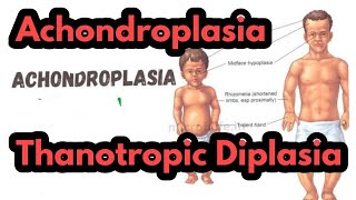 AchondroplasiaThanotropic DiplasiaDifference between Achondroplasia and Thanotropic DiplasiaRobin [upl. by Ainegul]