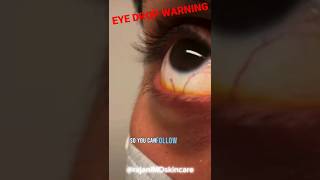 URGENT EYE DROP WARNING  FDA [upl. by Eedyah]