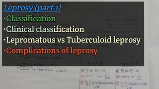 Leprosy Part1  Classification  Complications of leprosy  Lepra reactions  Microbiology [upl. by Nivat148]