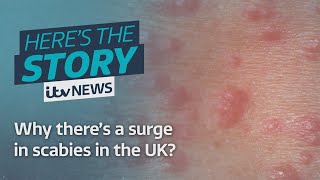 Why there’s a surge in scabies in the UK  ITV News [upl. by Iturhs762]