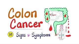 Colon cancer  20 Signs amp Symptoms  Clearly Explained  Cancer Series [upl. by Aneert]