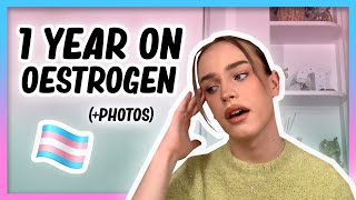 1 YEAR ON OESTROGEN Transition update with photos  Hormone Diaries [upl. by Asit]