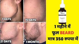 1 month results of minoxidil man matters  man matters beardmax 1 month results  man matters beard [upl. by Elayor646]