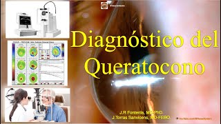 Diagnóstico del Queratocono [upl. by Notneuq904]