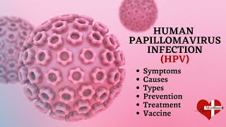 Human papillomavirus infection  HPV  What is HPV amp How do you get it [upl. by Sewel]