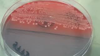 Klebsiella oxytoca on CLED Agar [upl. by Casar]