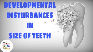 DEVELOPMENTAL DISTURBANCES IN SIZE OF TEETH [upl. by Elayor337]