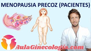 MENOPAUSIA PREMATURA o PRECOZ PACIENTES Necesidad de tratamiento  Ginecología y Obstetricia [upl. by Cnahc]