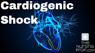 How to Manage Cardiogenic Shock [upl. by Clemens]