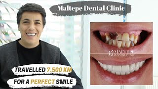 Full Mouth Restoration  Maltepe Dental Clinic Istanbul  Turkey [upl. by Lacagnia]