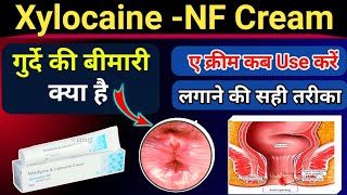 Xylocaine NF Cream  गुदे के की बीमारी में जरूर use करे  गुदे दर्द खुजलीफटनालॉलीपन के लिए [upl. by Oilalue]