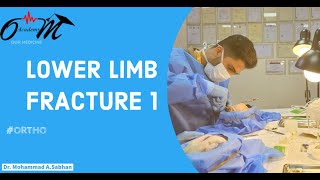 Lower Limb Fracture  1  ortho [upl. by Charley]