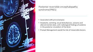 Headaches in pregnancyTOG article [upl. by Had]