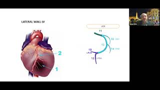 management of ischemic heart for non cardiac surgery [upl. by Nagle]