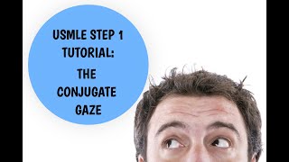 USMLE Step 1 Tutorial  Conjugate Gaze Explained [upl. by Woodrow75]