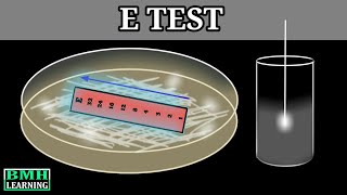 E Test  E Test For Antibiotic Susceptibility  MIC Determination By E Test  Epsilometer Test [upl. by Wivina]