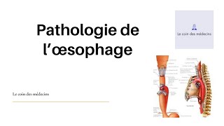 Pathologie de l’œsophage [upl. by Ayyn440]