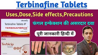 Terbinafine tablets ip 250 mg  Terbinaforce tablet uses dose side effects  फंगल इन्फेक्शन की दवा [upl. by Amethist]