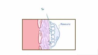 Membranous glomerulonephritis membranous nephropathy causes amp symptoms [upl. by Roux]