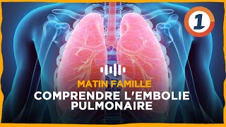 Comprendre lembolie pulmonaire [upl. by Katinka]