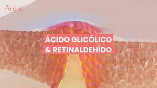 Innovación Cleanance Comedomed Peeling [upl. by Sachi]