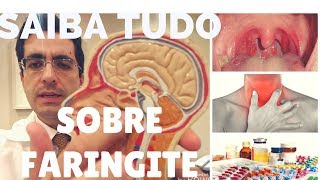 FARINGITE O QUE É  QUAIS SÃO AS CAUSAS E COMO PREVENIR Dr Paulo Mendes Jr Otorrino em Curitiba [upl. by Notserp117]