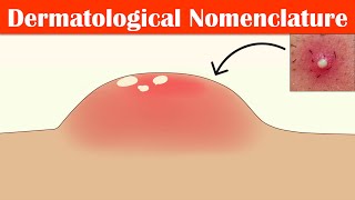 Describing Skin Lesions Dermatological Nomenclature  Macule Papule Pustule Vesicle amp Others [upl. by Yelad375]