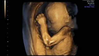 3D ultrasound 25 weeks 4D view of baby 25 week pregnancy baby girl first view [upl. by Eimme179]