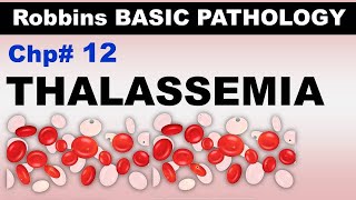 Ch12  Thalassemias  αThalassemia  βThalassemia  Blood Pathology  Dr Asif Lectures [upl. by Ynalem818]