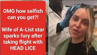 quotActress Jenny Mollen Sparks Outrage After Flying with Head Lice  Full Storyquot [upl. by Namreh]