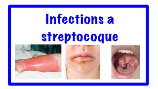 🔵infection à streptocoque 👹 streptococcies [upl. by Robb]