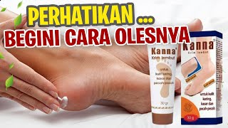 PERHATIKAN  Begini Cara Pakai Kanna Cream Untuk Mengatasi Kaki Pecahpecah [upl. by Tnahsarp19]