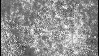 Pseudomonas aeruginosa PAO1 twitching motility [upl. by Ail490]