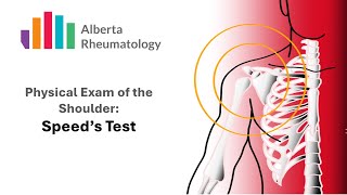 Speeds Test Rheumatology Shoulder Physical Exam Special Tests [upl. by Anires]