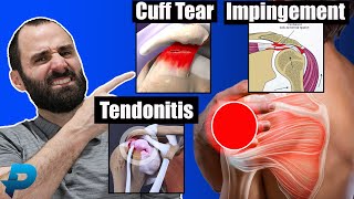 Shoulder Impingement vs Rotator Cuff Tendonitis vs Rotator Cuff Tear l Shoulder Pain [upl. by Tybie679]