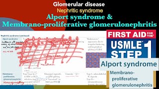 Alport syndrome amp Membranoproliferative glomerulonephritis in HindiUrdu by first aid for step 1 [upl. by Aldos]