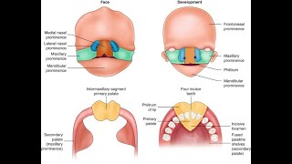 Development of the Intermaxillary segment and Adult derivatives of intermaxillary segment Process [upl. by Eitsirhc]