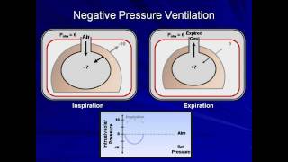 An Introduction to Mechanical Ventilation Mechanical Ventilation  Lecture 1 [upl. by Haisa]