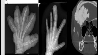 Msk spotters 2 radiology 15 cases in 15 minutes radiopedia mrictxrayultrasoundanazomybasics [upl. by Nor602]