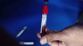 blood 🩸 sample collection step by step 💉🩸doctor pathology viralvideo trendingshorts [upl. by Farhsa]