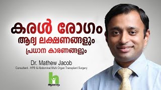 കരൾ രോഗത്തിന്റെ ഈ ലക്ഷണങ്ങൾ സൂക്ഷിക്കുക  Liver Disease Malayalam Health Tips [upl. by Florinda760]