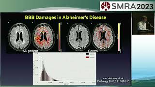 Plenary Session New Horizons  Blood brain barrier permeability imaging  Danny Wang [upl. by Freida]