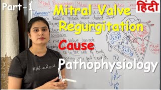 Mitral Valve Regurgitation in Hindi  Causes  Pathophysiology  Part1 [upl. by Kind]