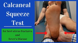 Calcaneal Squeeze Test Heel Squeeze [upl. by Diley127]