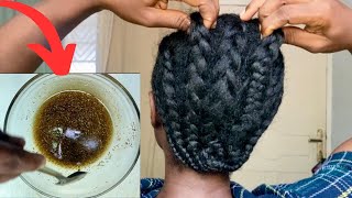 Your hair will never stop growing How to make Rosemary and cloves oil Fast hair growth [upl. by Ahsie]