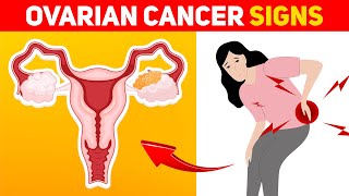 9 Warning Signs of Ovarian Cancer Every Woman Should Know [upl. by Noisla]