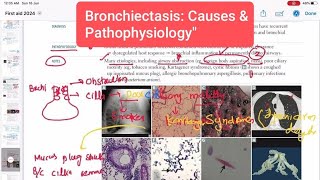 Bronchiectasis Causes amp Pathology Respiratory 38  First Aid USMLE Step 1 in UrduHindi [upl. by Lonergan233]