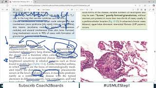 Chp13 Robbins Patho  Lung Pathology  Hypersensitivity Pneumonitis Restrictive Lung Disorders [upl. by Ashok]